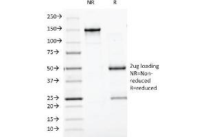 SDS-PAGE (SDS) image for anti-B-Cell CLL/lymphoma 10 (BCL10) (AA 122-168) antibody (ABIN6940985)