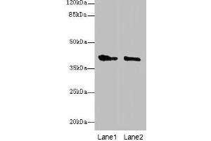 Western blot All lanes: GPR17 antibody at 10 μg/mL Lane 1: Mouse brain tissue Lane 2: Human high value serum Secondary Goat polyclonal to rabbit IgG at 1/10000 dilution Predicted band size: 41, 38 kDa Observed band size: 41 kDa (GPR17 抗体  (AA 1-36))