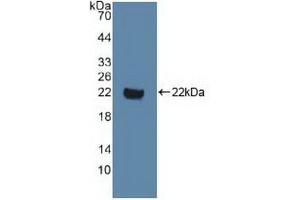 Detection of Recombinant DVL1, Human using Polyclonal Antibody to Dishevelled, Dsh Homolog 1 (DVL1) (DVL1 抗体  (AA 150-285))