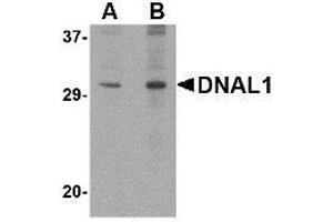 Western blot analysis of DNAL1 in 3T3 cell lysate with AP30294PU-N DNAL1 antibody at (A) 1 and (B) 2 μg/ml. (DNAL1 抗体  (C-Term))