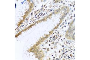 Immunohistochemistry of paraffin-embedded human stomach using TMEM189 antibody (ABIN6134447, ABIN6149262, ABIN6149263 and ABIN6224423) at dilution of 1:100 (40x lens). (TMEM189 抗体  (C-Term))