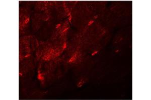 Immunofluorescence of TMEM38A in mouse skeletal muscle tissue with TMEM38A antibody at 20 μg/ml. (TMEM38A 抗体  (C-Term))