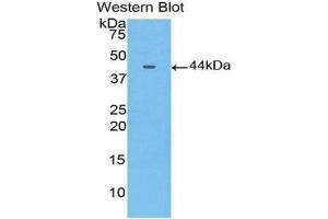 Western Blotting (WB) image for anti-Gastrointestinal Cancer Antigen CA19-9 (CA 19-9) (AA 35-361) antibody (ABIN5661981) (CA 19-9 抗体  (AA 35-361))