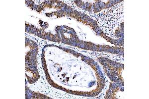 IHC analysis of SUMF2 using anti-SUMF2 antibody (ABIN7600954).