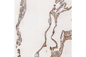 Immunohistochemical staining (Formalin-fixed paraffin-embedded sections) of human lung with PAG1 polyclonal antibody  shows cytoplasmic and membranous positivity in alveolar cells at 1:200-1:500 dilution. (PAG1 抗体)