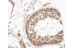 ABIN6266626 at 1/100 staining human testis tissue sections by IHC-P. (Presenilin 1 抗体  (Internal Region))