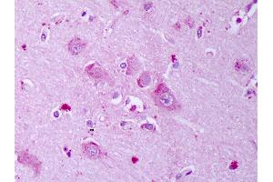 Anti-GABRB1 antibody IHC of human brain, cortex neurons. (GABRA1 抗体  (AA 327-450))