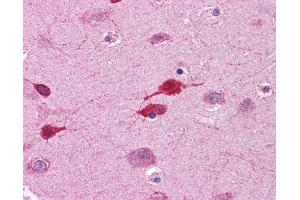Immunohistochemistry (IHC) image for anti-Wingless-Type MMTV Integration Site Family, Member 5A (WNT5A) (AA 180-229) antibody (ABIN574490)