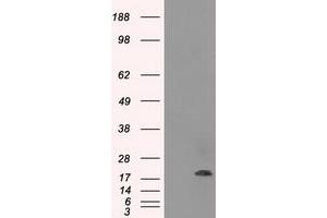 Image no. 1 for anti-Crystallin, alpha B (CRYAB) antibody (ABIN1497644) (CRYAB 抗体)