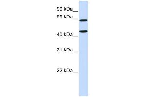 WB Suggested Anti-TRIM54 Antibody Titration:  0. (TRIM54 抗体  (N-Term))