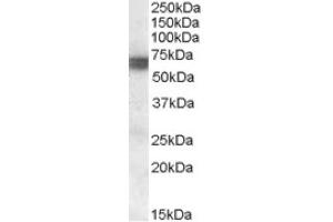 Image no. 1 for anti-Bridging Integrator 1 (BIN1) (Internal Region) antibody (ABIN375175) (BIN1 抗体  (Internal Region))