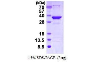 Image no. 1 for Methylmalonic Aciduria (Cobalamin Deficiency) CblC Type, with Homocystinuria (MMACHC) protein (His tag) (ABIN1098298)
