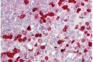 Anti-CLIC4 antibody IHC staining of human spleen. (CLIC4 抗体  (AA 1-50))