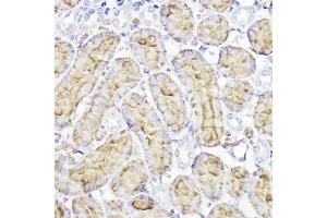 Immunohistochemistry of paraffin-embedded rat kidney using Aquaporin-1  Rabbit pAb (ABIN7265651) at dilution of 1:100 (40x lens). (Aquaporin 1 抗体  (C-Term))