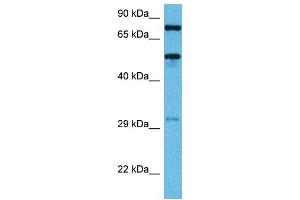 Host:  Mouse  Target Name:  TFE3  Sample Tissue:  Mouse Heart  Antibody Dilution:  1ug/ml (TFE3 抗体  (Middle Region))