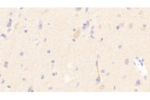 Detection of LDLR in Human Cerebrum Tissue using Polyclonal Antibody to Low Density Lipoprotein Receptor (LDLR) (LDLR 抗体  (AA 497-742))