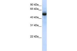 WB Suggested Anti-CXorf34 Antibody Titration:  0. (TRMT2B 抗体  (N-Term))