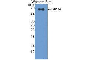 Detection of Recombinant CLEC11A, Human using Polyclonal Antibody to C-Type Lectin Domain Family 11, Member A (CLEC11A) (CLEC11A 抗体  (AA 22-323))