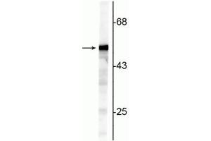 Western blot of NIH 3T3 cell lysate showing specific immunolabeling of the ~50 kDa Vimentin protein. (Vimentin 抗体)