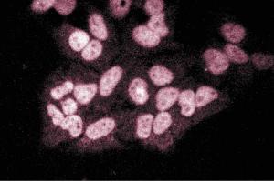 Immunofluorescent staining of Hela cells. (EZH2 抗体  (AA 156-256))