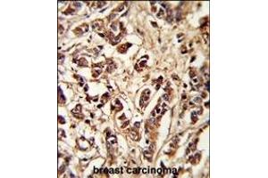 Immunohistochemistry (Paraffin-embedded Sections) (IHC (p)) image for anti-Pericentriolar Material 1 (PCM1) (AA 632-661) antibody (ABIN391696)