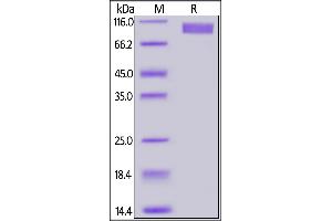 Biotinylated Human GUCY2C, Fc,Avitag on  under reducing (R) condition.