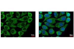 ICC/IF Image COX6B1 antibody [N2C3] detects COX6B1 protein at mitochondria by immunofluorescent analysis. (COX6B1 抗体  (C-Term))