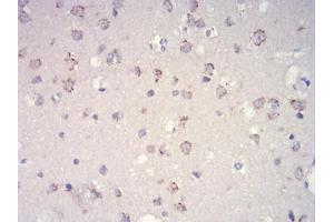 Immunohistochemical analysis of paraffin-embedded brain tissues using mTOR mouse mAb with DAB staining. (MTOR 抗体  (AA 2311-2529))