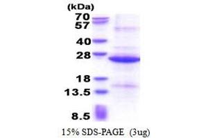 REX1, RNA Exonuclease 1 Homolog (REXO1) (AA 1060-1221) protein (His tag)