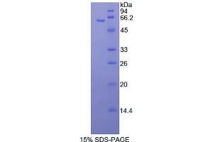 SDS-PAGE analysis of Human MAP2K4 Protein. (MAP2K4 蛋白)