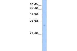 WB Suggested Anti-NSUN5C Antibody Titration:  2. (NSUN5P2 抗体  (Middle Region))