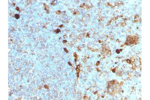 Immunohistochemistry (IHC) image for anti-serpin Peptidase Inhibitor, Clade A (Alpha-1 Antiproteinase, Antitrypsin), Member 1 (SERPINA1) antibody (ABIN6940312)