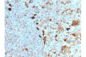 Formalin-fixed, paraffin-embedded human Tonsil stained with Alpha-1-Antitrypsin Mouse Monoclonal Antibody (AAT/1378). (SERPINA1 抗体)