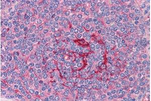 Immunohistochemistry (IHC) image for anti-GA-Binding Protein Subunit beta-2 (GABPB2) (Internal Region) antibody (ABIN190778)