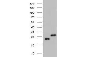Image no. 1 for anti-Ubiquitin-Conjugating Enzyme E2E 3 (UBE2E3) antibody (ABIN1501628) (UBE2E3 抗体)