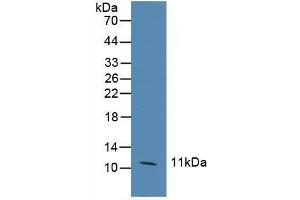 Detection of CCL6 in Human Hela Cells using Polyclonal Antibody to Chemokine (C-C motif) ligand 6 (CCL6) (CCL6 抗体  (AA 21-115))