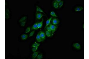 Immunofluorescence staining of HepG2 cells with ABIN7147479 at 1:100, counter-stained with DAPI. (GLTPD1 抗体  (AA 1-214))