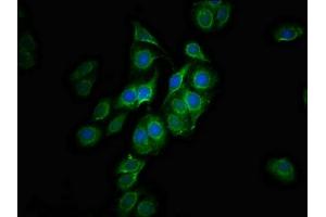Immunofluorescence staining of HepG2 cells with ABIN7147479 at 1:100, counter-stained with DAPI. (GLTPD1 抗体  (AA 1-214))