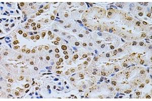 Immunohistochemistry of paraffin-embedded Rat kidney using MDM2 Polyclonal Antibody at dilution of 1:200 (40x lens). (MDM2 抗体)