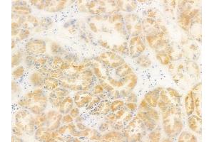 ABIN6264828 and ABIN6278632 at 1/100 staining human normal kidney tissue by IHC-P. (RPL14 抗体  (Internal Region))