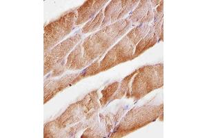 Immunohistochemical analysis of paraffin-embedded M. (MUSK 抗体  (AA 600-860))