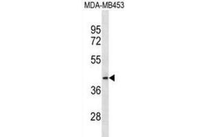 Western Blotting (WB) image for anti-Mitochondrial Ribosomal Protein L46 (MRPL46) antibody (ABIN3000730) (MRPL46 抗体)