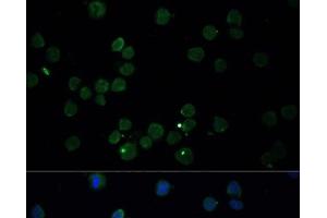 Immunofluorescence analysis of THP-1 cells using CHAT Polyclonal Antibody at dilution of 1:100. (Choline Acetyltransferase 抗体)