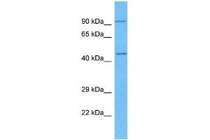 Host:  Rabbit  Target Name:  E2F3  Sample Tissue:  Human Lung Tumor  Antibody Dilution:  1ug/ml (E2F3 抗体  (C-Term))