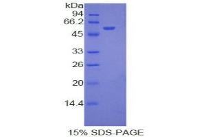 SDS-PAGE analysis of Rat Ephrin A4 Protein. (EFNA4 蛋白)