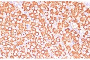 Immunohistochemistry of paraffin-embedded Rat ovary using MAP2K3 Polyclonal Antibody at dilution of 1:100 (40x lens). (MAP2K3 抗体)