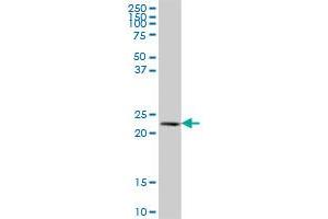 NAT9 MaxPab polyclonal antibody. (NAT9 抗体  (AA 1-207))