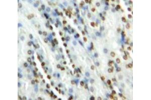 Used in DAB staining on fromalin fixed paraffin-embedded Kidney tissue (GATA2 抗体  (AA 175-480))