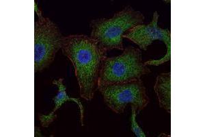 Immunofluorescence analysis of A549 cells using RAB25 mouse mAb (green). (RAB25 抗体)