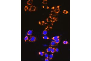 Immunofluorescence analysis of NIH-3T3 cells using IFN Rabbit pAb (ABIN7267947) at dilution of 1:100 (40x lens). (IFNAR1 抗体  (AA 470-557))
